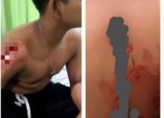 Beredarnya Video Korban Begal Berlumuran Darah Di Jalan Parit Indah Menjadi Viral di Pekanbaru